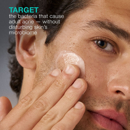 Acne Biotic Moisturizer