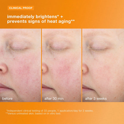 BioLumin-C Heat Aging Protector SPF 50