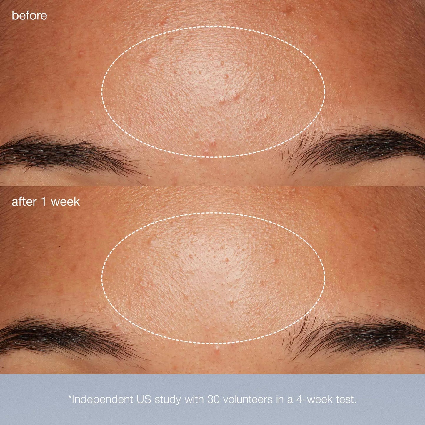 Daily Microfoliant Refill