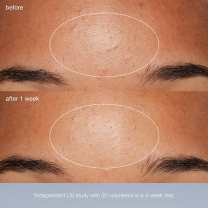 Daily Microfoliant Refill