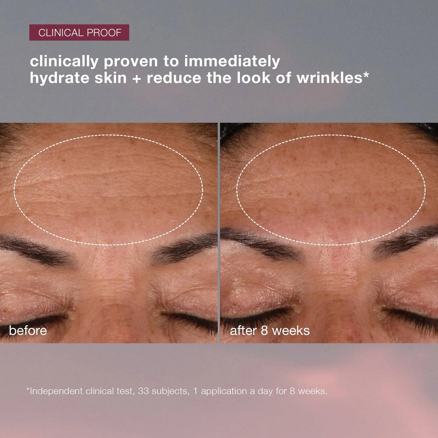 Dynamic Skin Recovery SPF50